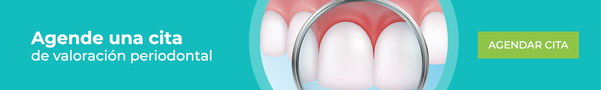 Banner cita evaluación periodontal